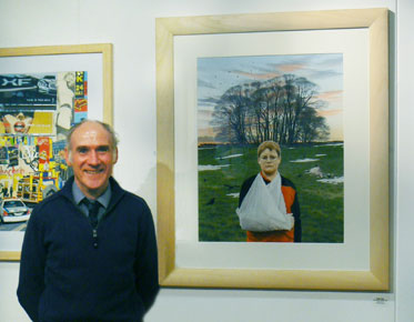 Artist Roger Allen with painting Boy with a broken arm